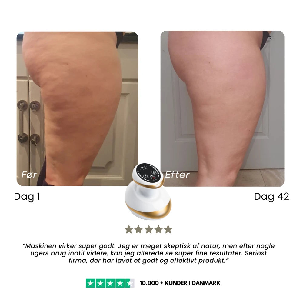 CelluSmooth Anti Cellulite Massager