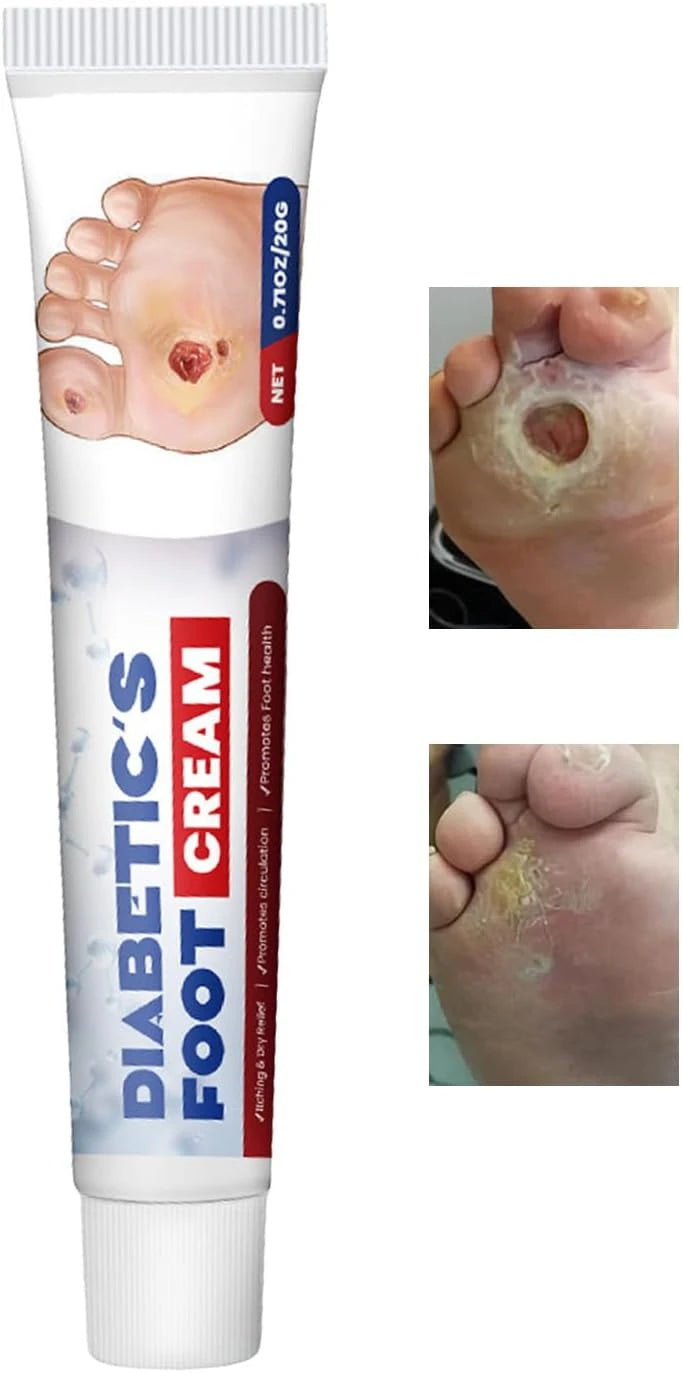 Sugar Guard Healing Foot Cream