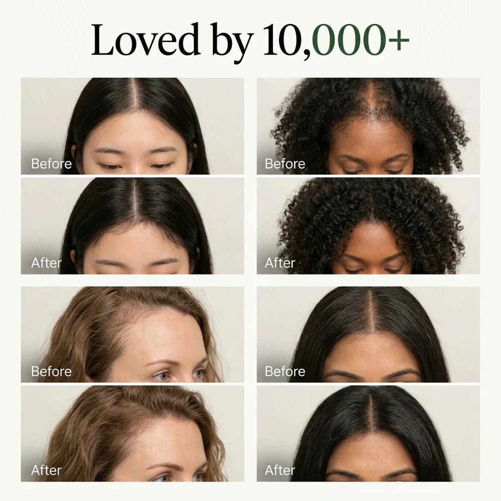 Korean Scalp Revival Bar