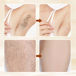 Hair Removal Cream Skin Softer