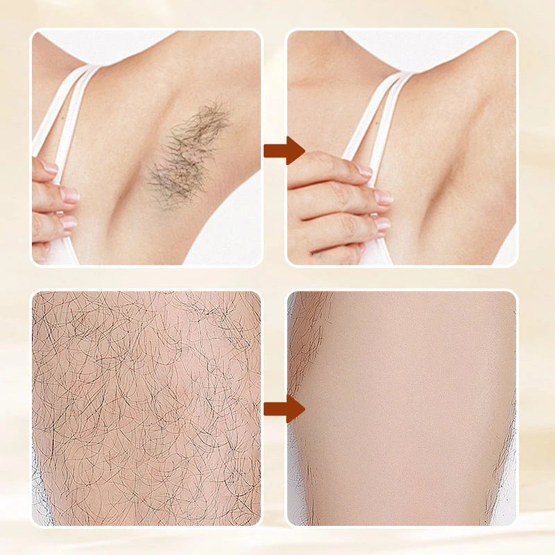 Hair Removal Cream Skin Softer