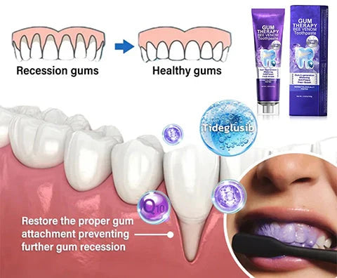 Bee Venom Toothpaste for Sensitive Gums