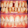 Bee Venom Toothpaste for Sensitive Gums