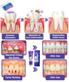 Bee Venom Toothpaste for Sensitive Gums