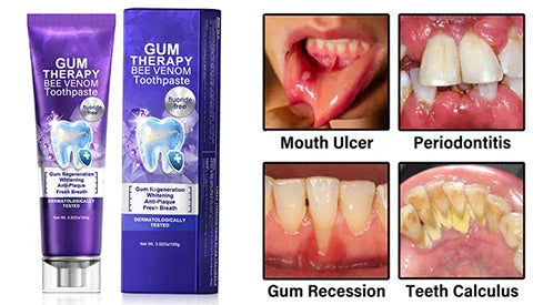 Bee Venom Toothpaste for Sensitive Gums