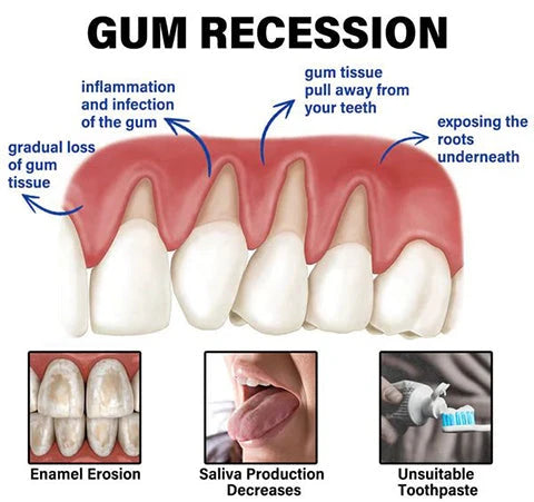 Bee Venom Toothpaste for Sensitive Gums