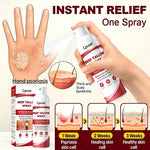 Beef Tallow Itch Relief Spray