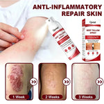 Beef Tallow Itch Relief Spray