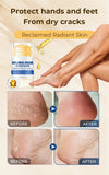 Hydrating Anti Cracking Foot Cream