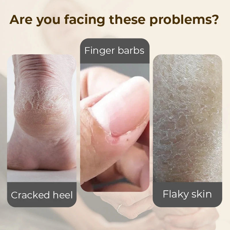 Hydrating Anti Cracking Foot Cream