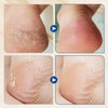 Hydrating Anti Cracking Foot Cream