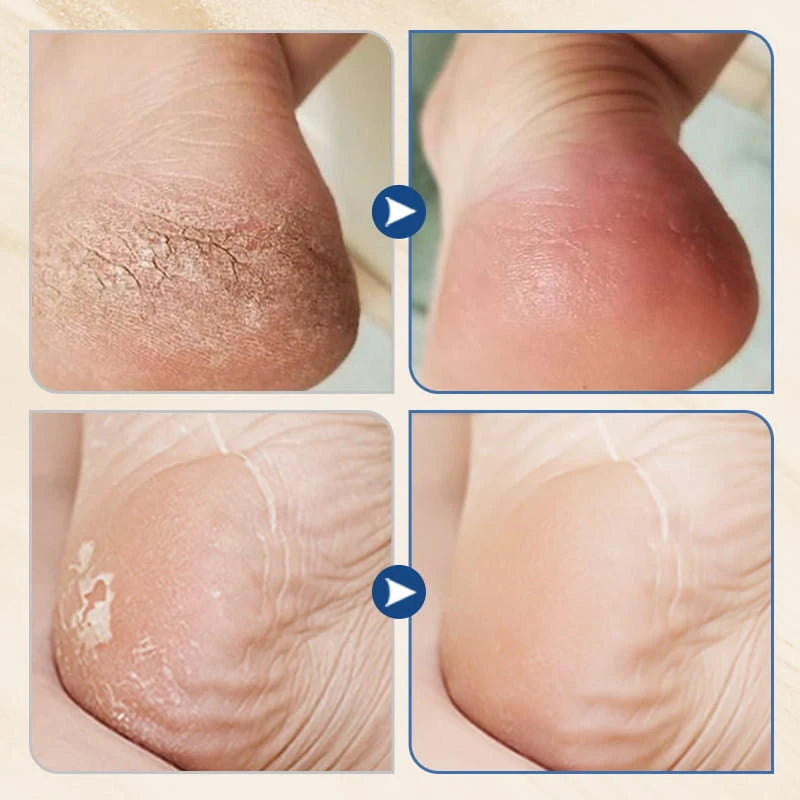 Hydrating Anti Cracking Foot Cream