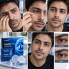 EyeRenew Microneedle Under-Eye Patches