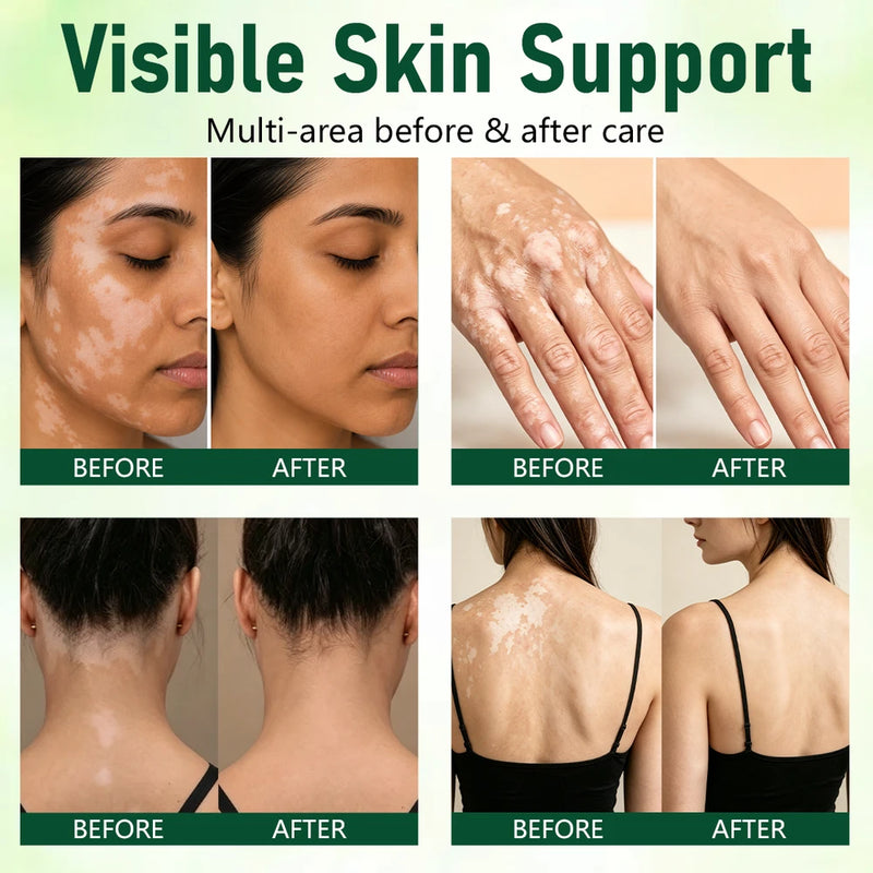 EvenTone Herbal Skin Cream