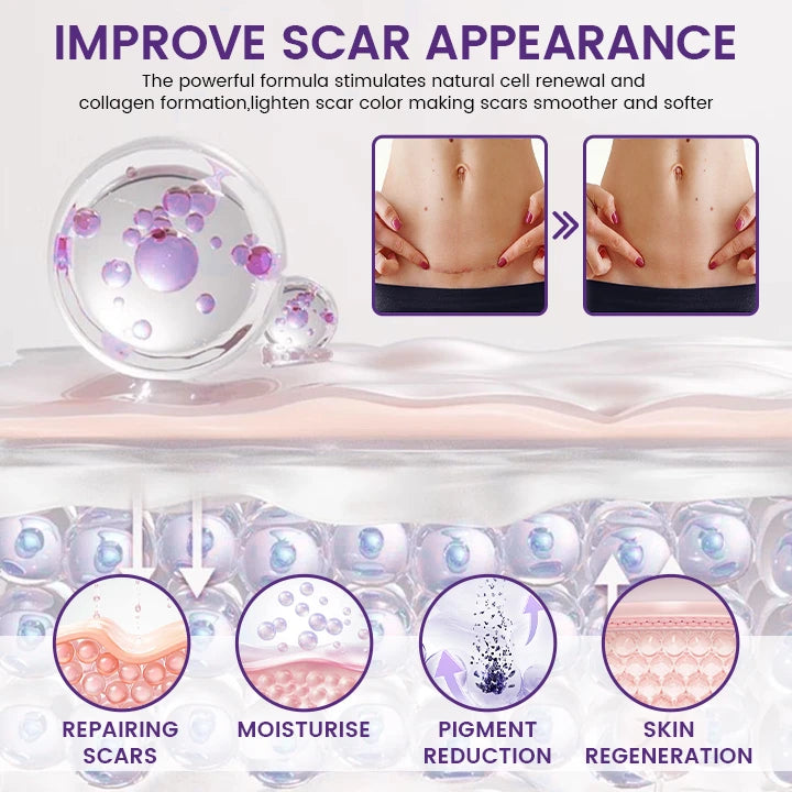Scarlisse Intensive Scar Care Gel