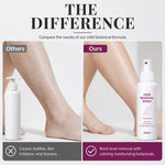 Velmora SmoothSkin Hair Removal Spray
