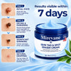 Mirevane 7-Day Skin Tag Eraser Cream