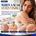 ScarLuxe Advanced Bioactive Microneedle Scar Tape